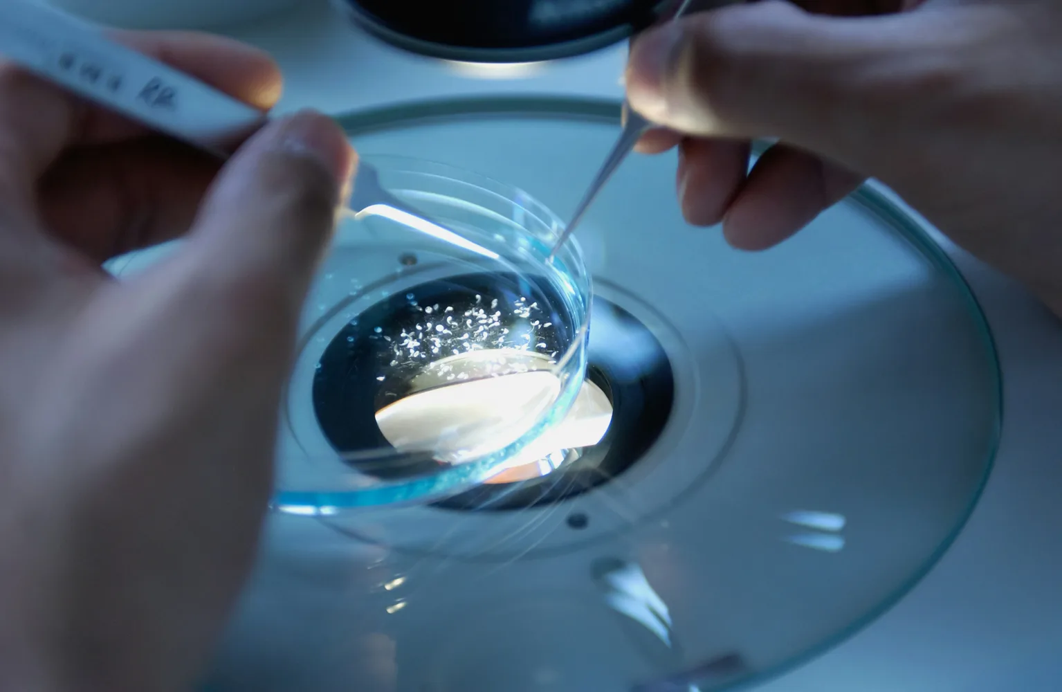 Gut-Brain Connection: How Gut Health Impacts Neurodegenerative Disease Risk