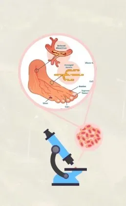 Sinapic Acid: A Natural Boost for Diabetic Wound Healing?