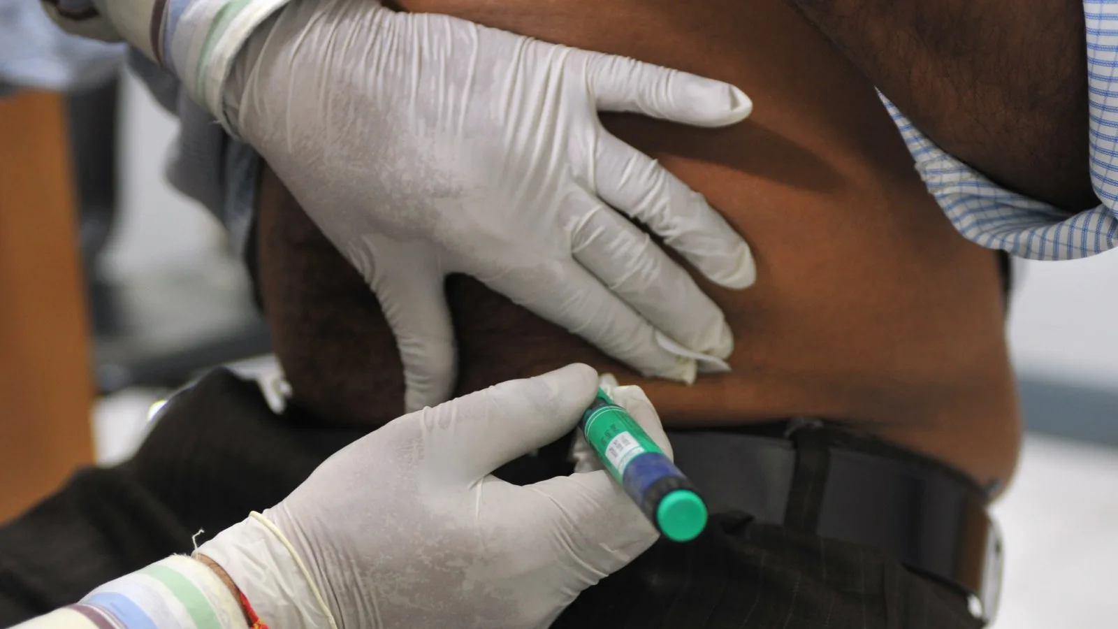 Semaglutide Offers Kidney Protection in Type 2 Diabetes and CKD, JACC Study Confirms
