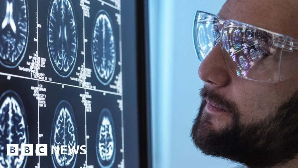 Semaglutid kann Fortschreiten der Alzheimer-Krankheit nicht verlangsamen