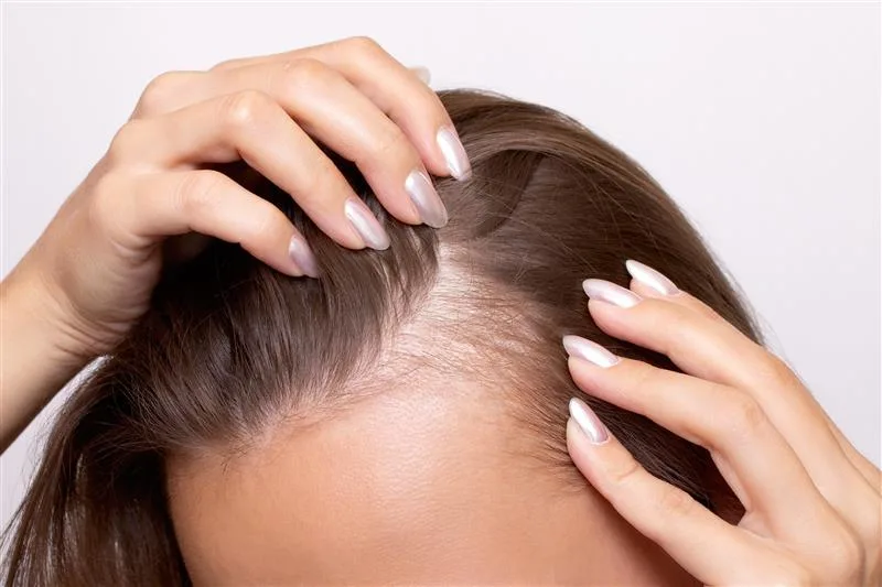 GLP-1s and Hair Thinning: Expert Advice for Management