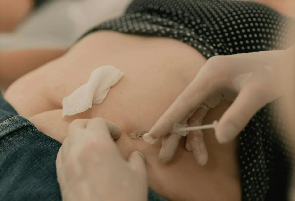Wegovy Side Effects: Black Tongue, Pain, Gallbladder Removal in Woman's Story