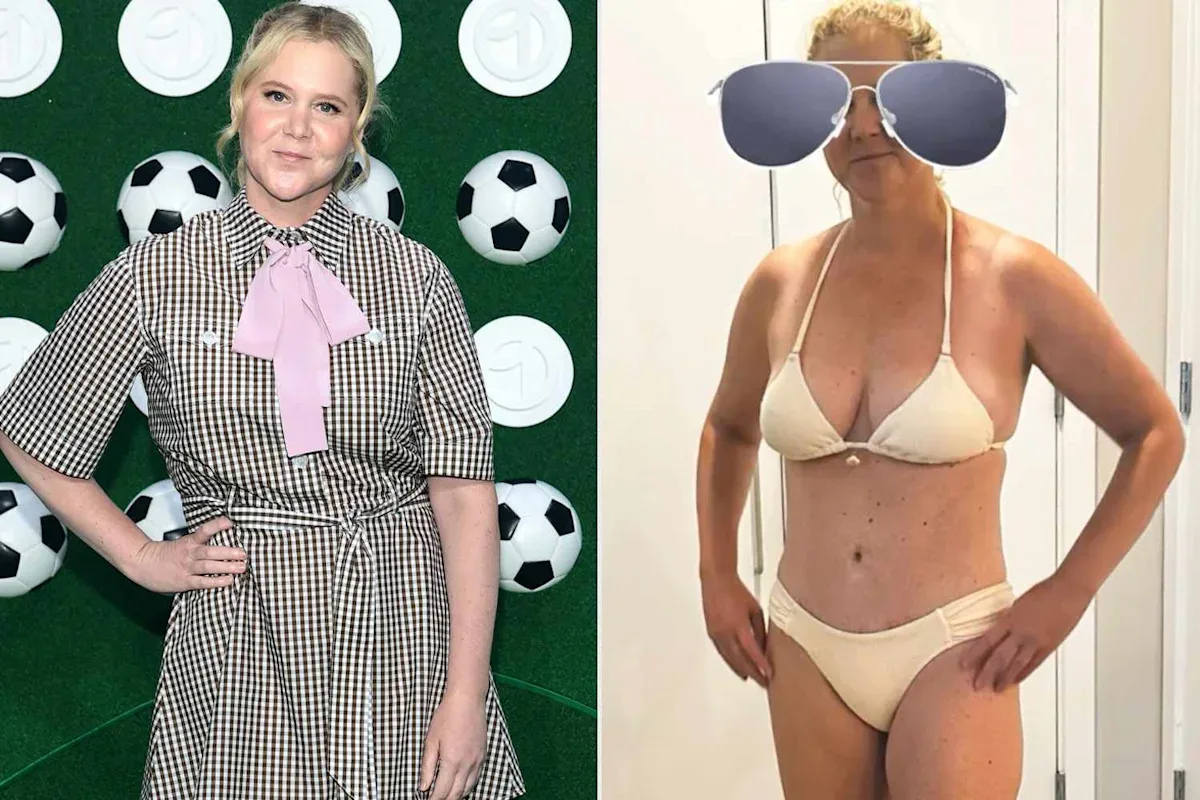 Amy Schumer Shows Off Ongoing Weight Loss, Says C-Section Scar Makes Her a 'Warrior'